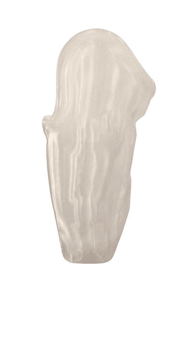 limb